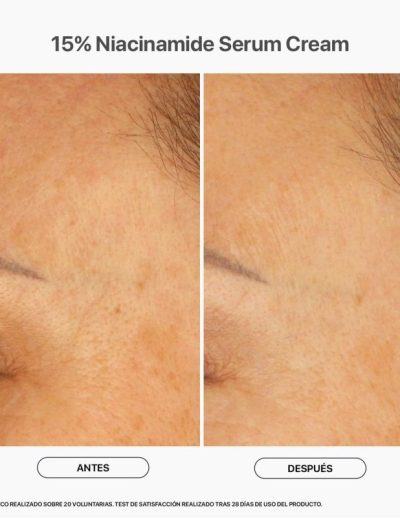 15-niacinamide-serum-cream-3.jpg