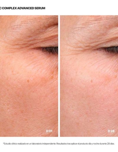 25-vit-c-complex-advanced-serum-9.jpg